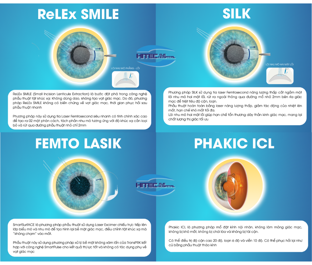 so-sanh-cac-phuong-phap-xoa-can-hien-dai-tai-hitec:-silk-relex-smile-lasik-va-phakic-icl