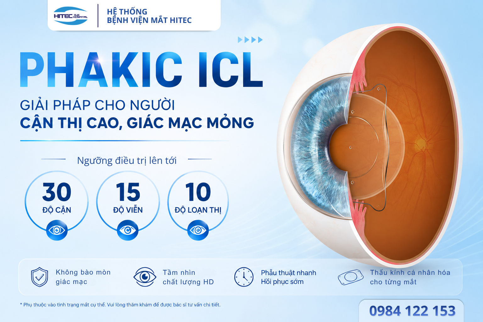 phakic-icl-la-gi-giai-phap-xoa-can-toi-uu-cho-nguoi-can-nang-giac-mac-mong